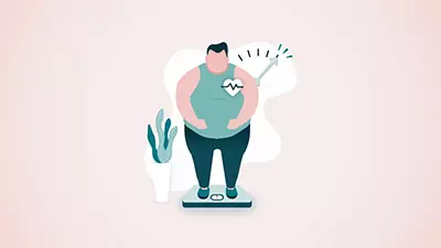 Obesity, the 21st Century pandemic